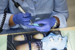 kurs_stomatologiczny_art_of_composite_16