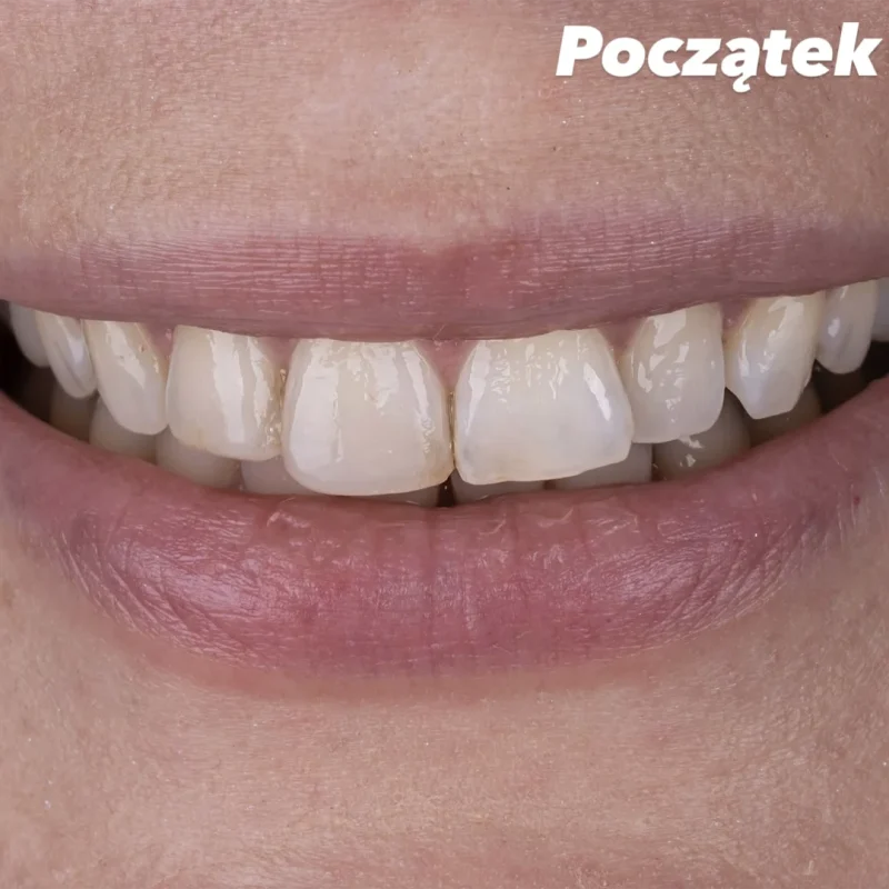 1 Kopia