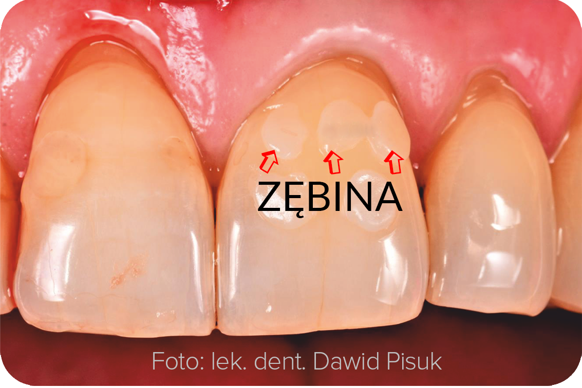 Zębina Do E Mailia