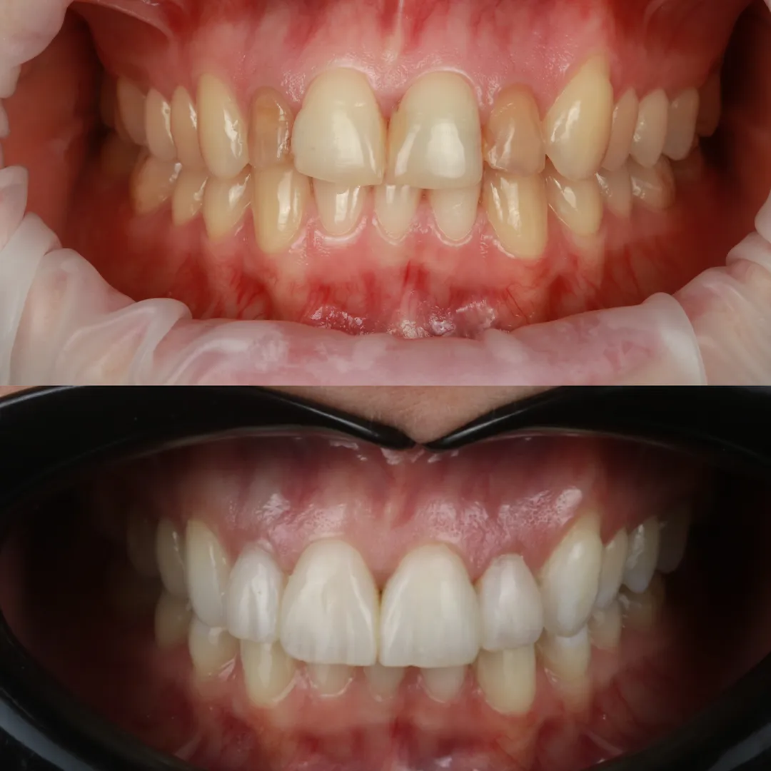 Porównanie przed i po – dodatkowe ujęcie, autor: lek. dent. Michał Sroka